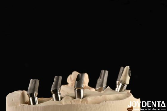Buy Custom Made Polished Titanium Abutment Cement Retetion V Shaped Thread Type online manufacture