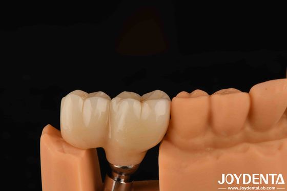 Buy V Shaped Thread Type Finished Abutments Compatibility With All Major Implant Systems online manufacture