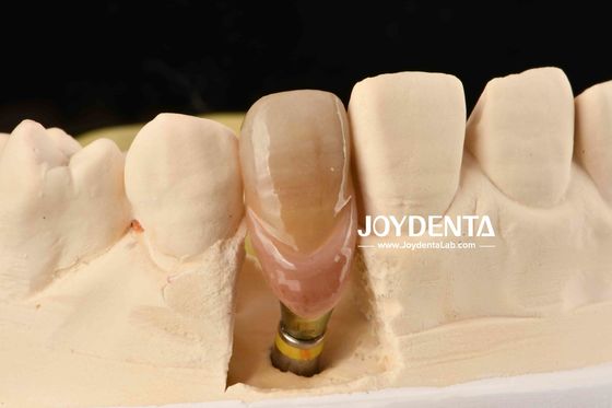 Buy 0° Angulation Finished Dental Abutments 1.5mm Thread Pitch Polished Surface online manufacture