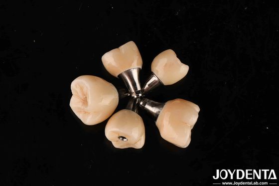 Buy Screw Retetion Titanium Abutments Internal Hex Connection For Dental Implants online manufacture
