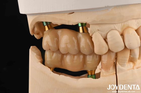 Buy 4.5mm Height Polished Internal Hex Dental Implant Abutments V Shape Screw Retained online manufacture