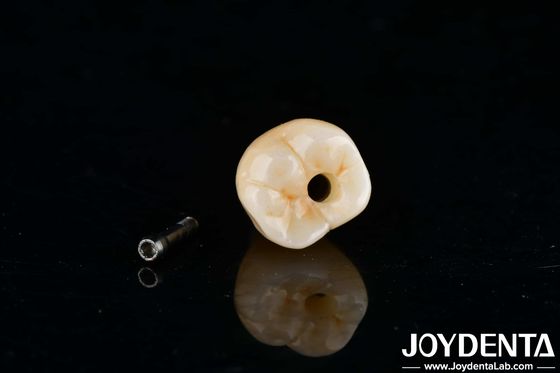 Buy Internal Hex Titanium Dental Implants Precision Machining With Zero Angulation online manufacture