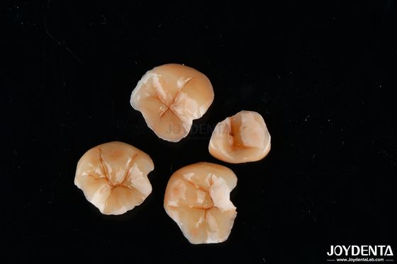 Buy Customizable Shape Composite Inlays And Onlays Dental Stain Resistance Long Lasting online manufacture