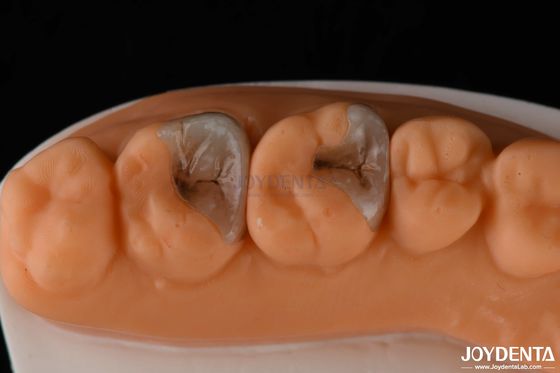 Buy Composite Inlays And Onlays For Dental Restoration Strong Bonding To Tooth Structure online manufacture