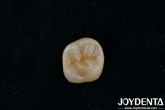 Buy Customizable Adhesive Zirconia Inlays Onlays High Translucency For Restoration online manufacture