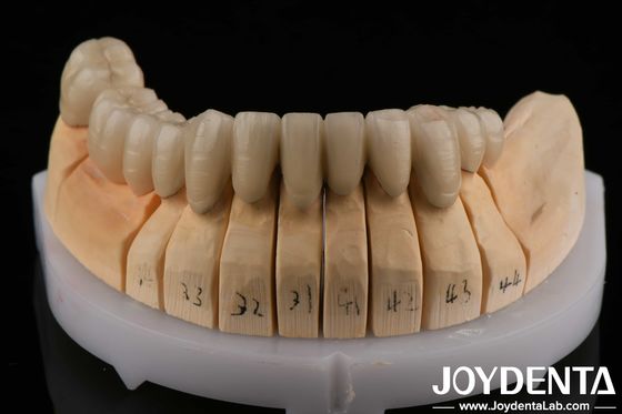 Buy Gold Alloy PFM Porcelain Fused to Metal Dental Compatible With Porcelain Layering online manufacture