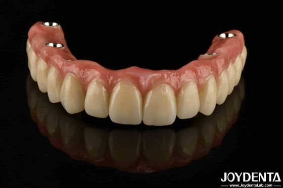 Buy Custom Titanium Malong Dental Hybrid Bridge Corrosion Resistance Adjustable online manufacture