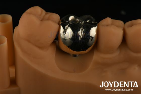 Buy Oral Rehabilitation Wax Casting FMC Full Metal Crown For Dental Clinical Repair online manufacture