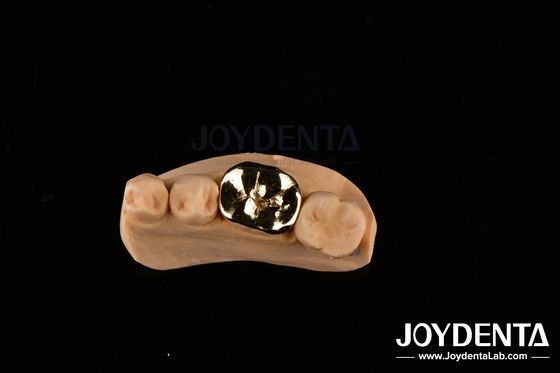 Buy Metallic FMC Oral Clinical Repair Dental Implant Materials with Abrasive Resistance online manufacture