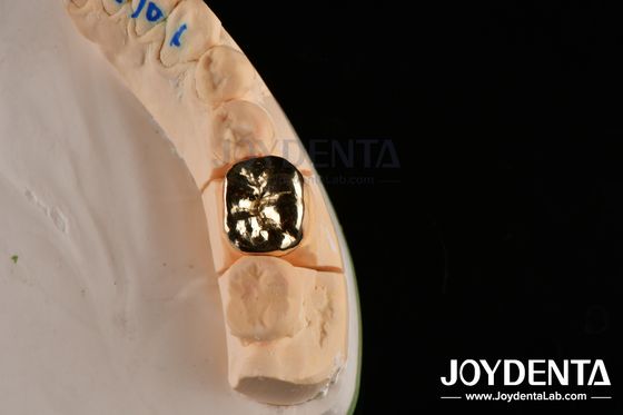 Buy Abrasive Resistance Dental Wax Casting FMC Crown For Oral Clinical Repair online manufacture