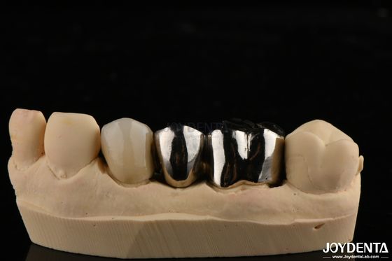 Buy Abrasion Resistant Metal Alloy Crown For Customized Dental Restorations online manufacture