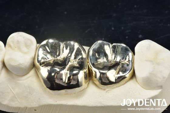Buy Wax Casting Dental Repair Full Metal Crown For Abrasion Resistant Oral Rehabilitation online manufacture