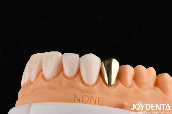 Buy Wax Casted Gold 60K Metallic Dental Crowns Abrasive Resistant Gold Tooth Crown online manufacture