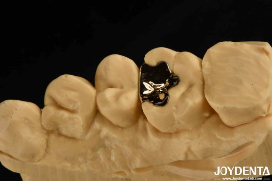 Buy Clinical Metallic Dental Gold Crown 60K Gold Tooth Cap For Oral Rehabilitation online manufacture