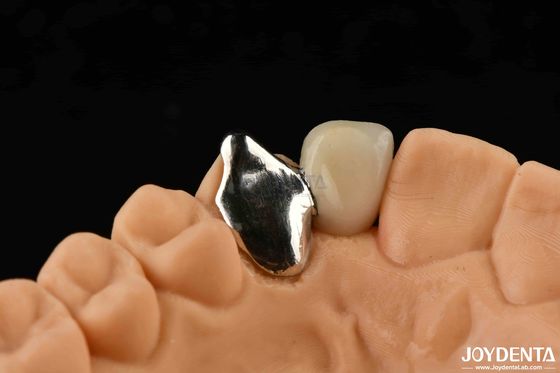 Buy Customizable Metallic Material PFM Maryland Dental Care Oral Clinical Repair online manufacture