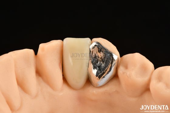 Buy Ideal Matching Clinical Bonding Maryland Dental For Oral Clinical Repair Work online manufacture