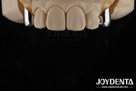 Buy Precision Removable Prosthesis Dental Implant Attachments Easy Clean Comfortable Fit online manufacture