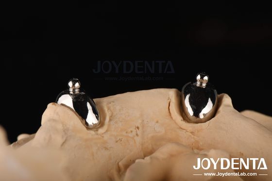 Buy Joydental dental lab Ball Attachment online manufacture