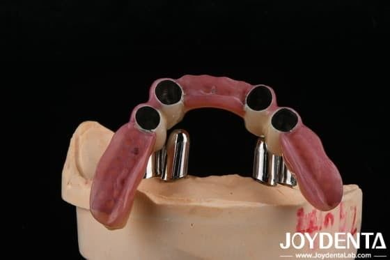 Buy Dental Precision Attachments Supports Partial Dentures Accurate Restorations online manufacture
