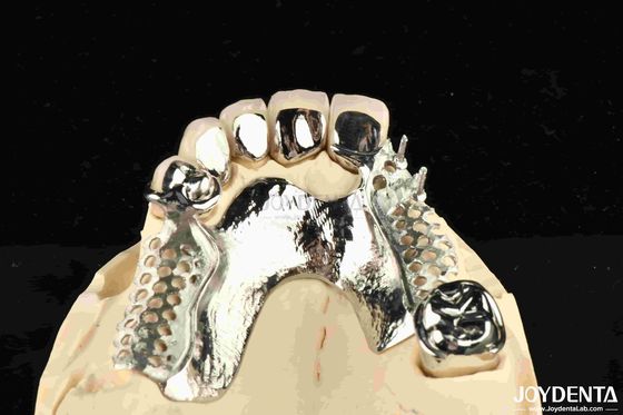 Buy Alloying Metal Dental Framework Removable Wearable For Dental Practitioners online manufacture