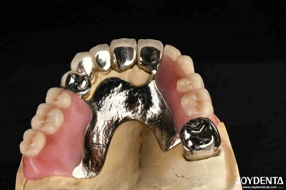 Buy Elaborate Framework Final Set Stable Dental Structure Designed Teeth Finish online manufacture