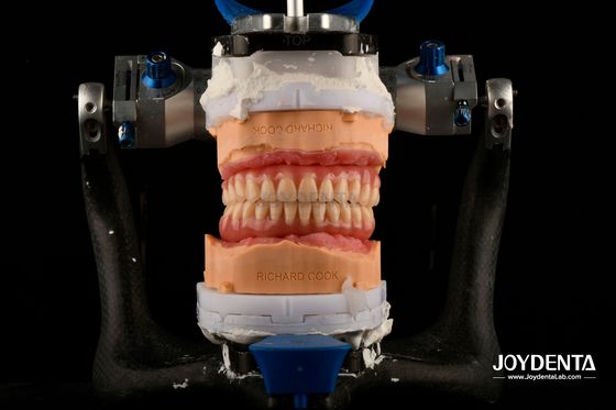 Buy Lightweight Comfortable Fit Acrylic Dental Denture Finish Professional Personalization online manufacture