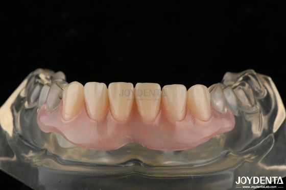 Buy Personalized Invisible Denture Finished With Advanced Tooth Arrangement Technology online manufacture
