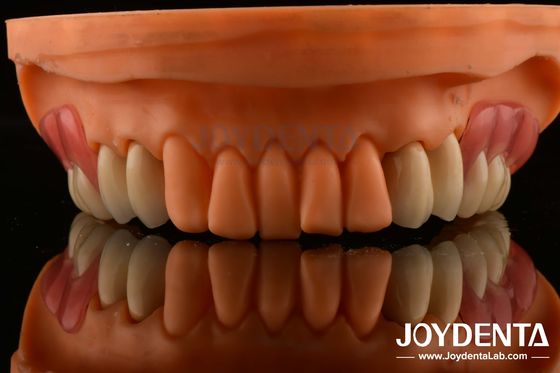 Buy Framework Setup Teeth Finish Elaborate Technology Beautiful Harmonious Appearance Design online manufacture