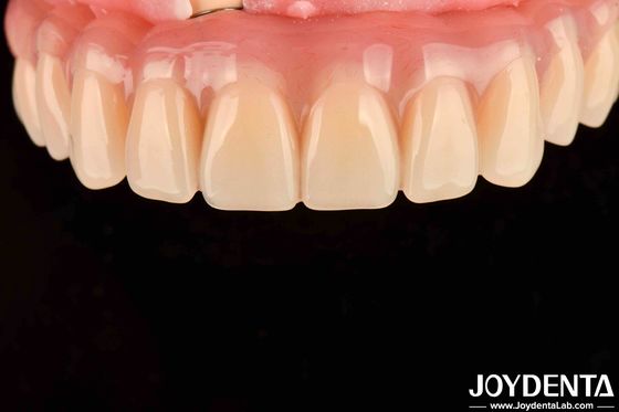 Buy Dental Treatment High Elasticity Acrylic False Teeth Finish For Tooth Arrangement online manufacture