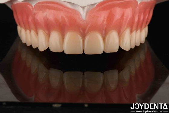 Buy Acrylic Teeth Finish Lightweight Resin Material Dental Restorations Tooth Arrangement online manufacture