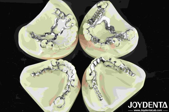 Buy Good Fit Dental Metal Framework Metallic Material For Durable Dental Restorations online manufacture