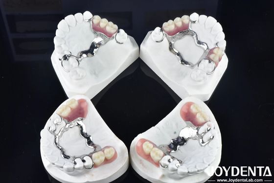 Buy Elaborate Technology Framework Set Up Teeth Finish for Stable Oral Structure online manufacture