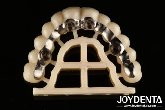 Buy Silver Finish Custom Abutments And Bars Accurate Fit Screw Retained Or Cement Retained online manufacture