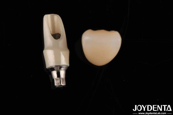 Buy Zirconia Custom Abutments And Bars Dental Restorations For Individual Patient's Anatomy online manufacture