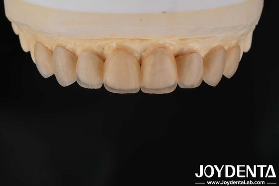 Buy Natural Appearance Glass Ceramic Veneers , Dental Clinic Veneers Strong Bond online manufacture