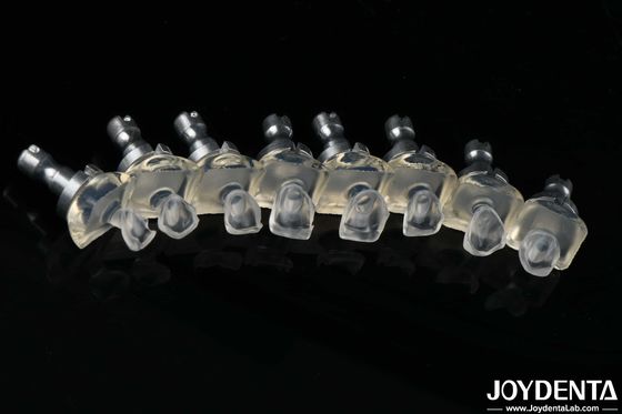 Buy Highly Translucent Glass Porcelain Teeth Veneers High Strength 0.3-0.8mm Thickness online manufacture
