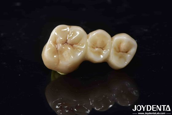 Buy High Biocompatibility Zirconia Full Contour Crown Perfect Fit High Strength online manufacture