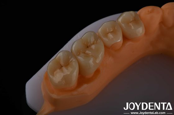 Buy High Aesthetics Full Contour Zirconia For Crowns Bridges Implants Dental Restorations online manufacture