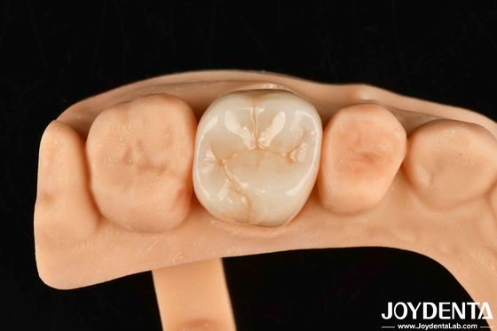 Buy High Wear Resistance Dental Full Zirconia High Strength Full Contour Zirconia Bridge online manufacture