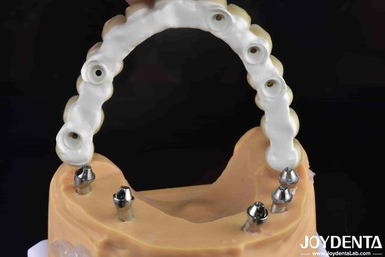 Buy High Strength Ti-Base Hybrid Zirconia Bridge Fracture Resistance Dental Solution online manufacture