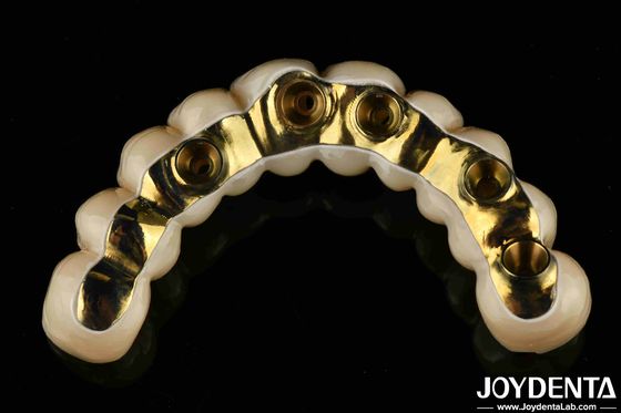 Buy Custom Made Ti-Bar Zirconia Hybrid Bridge Precision Fit Dental Prosthesis online manufacture