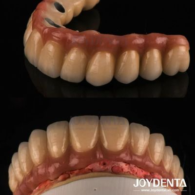 Buy Casting And Milling PFM Tooth Crown , Dental Restorations Porcelain Fused Metal Crown online manufacture