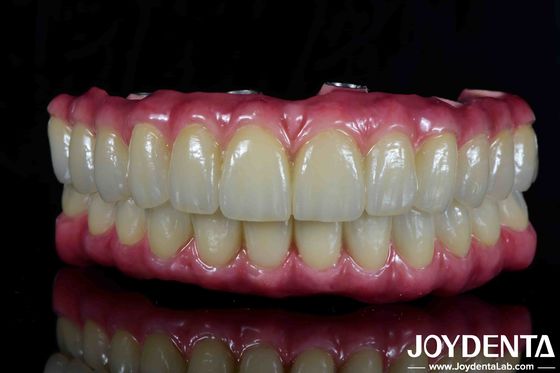 Buy Lightweight Dental Titanium Malong Hybrid Bridge Comfortable For Dental Restoration online manufacture