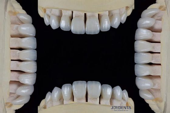 Buy Ultra Thin Feldspathic Veneer 0.3-0.5mm Thickness High Stain Resistance Precise Fit online manufacture
