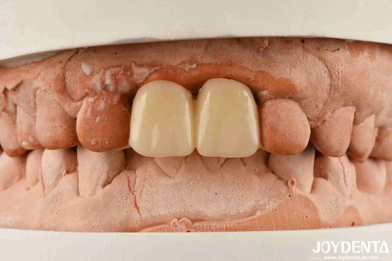 Buy Multilayer PMMA Polymethyl Methacrylate For Dental Restorations online manufacture