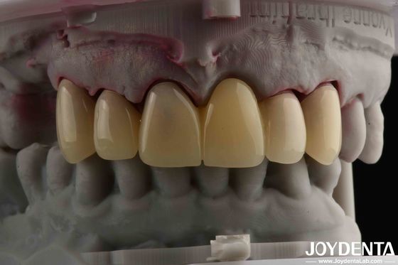 Buy CAD CAM Processing Dental PMMA Material Multilayer Design For Natural Shade Transitions online manufacture
