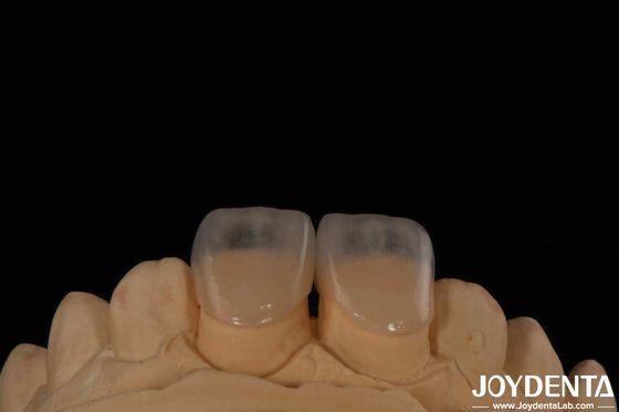 Buy Eco Friendly Micro Dental Teeth Veneer 0.2mm Thickness Smooth Texture online manufacture