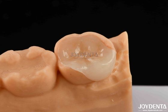 Buy polymerized porcelain Composite Inlay And Onlay Aesthetic And Durable Restorations online manufacture