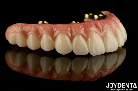 Buy Custom-made For Each Patient Ti-Bar Zirconia Hybrid Bridge For Long-lasting Dental Prosthesis online manufacture