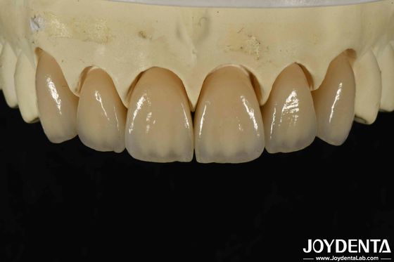 Buy Excellent Biocompatibility Layered Zirconia Within High Aesthetics And Density 6.0-6.1 G/cm3 online manufacture